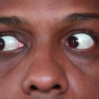 Omo My Eye Shine