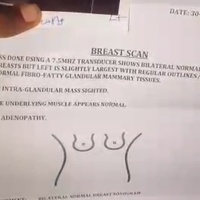 Breast Awareness
