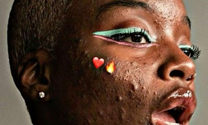 Help! My Pores Are Breathing