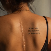 SCARS ARE THE TATTOOS OF STRENGTH 💪❤️