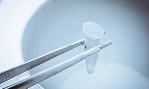 Why can't men freeze their sperms after 40 ?