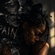 Pain