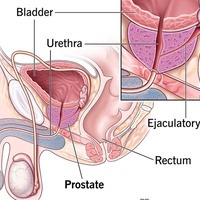 Call For Awareness: Prostate Cancer.