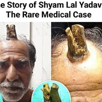 The man with a tree on his head