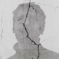 Scars