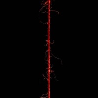 The Other End of My Thread.