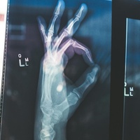 What a Neighbor's Stroke taught me